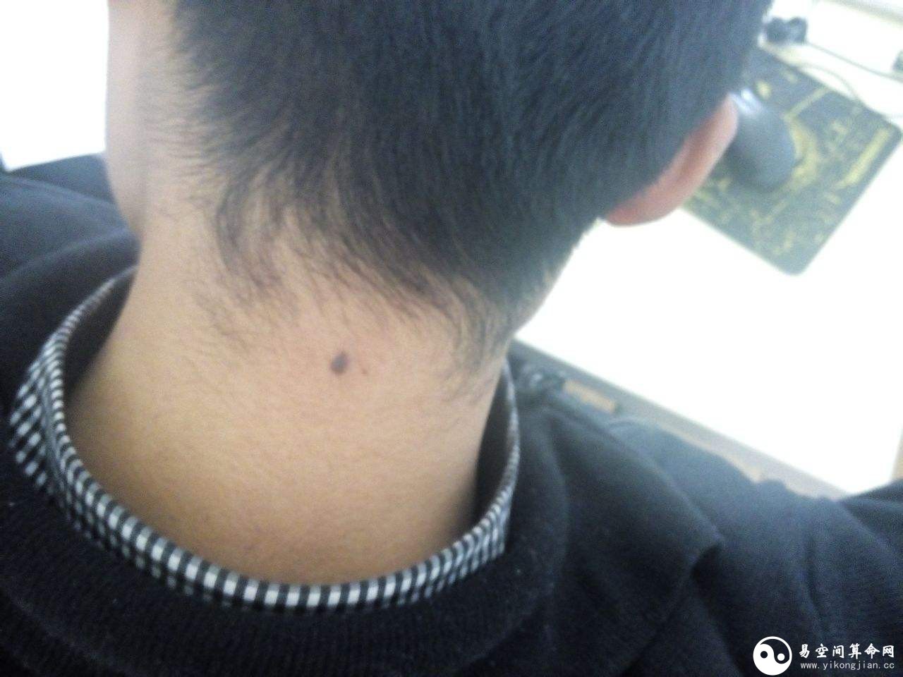 脖子上有痣的男人代表什么 脖頸上右側(cè)有長(zhǎng)痣代表什么