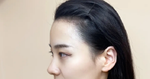 女性額頭寬大發(fā)際線高面相好不好？